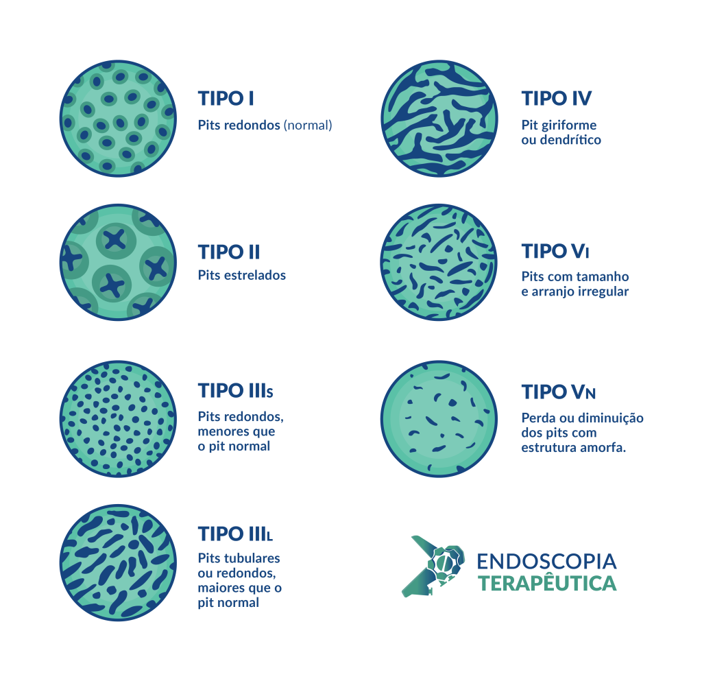 kudo classification