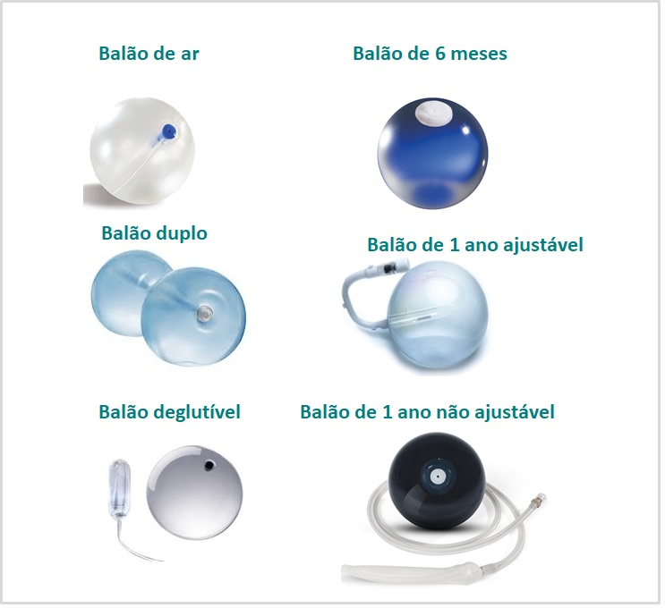 Tipos de balão intragástrico