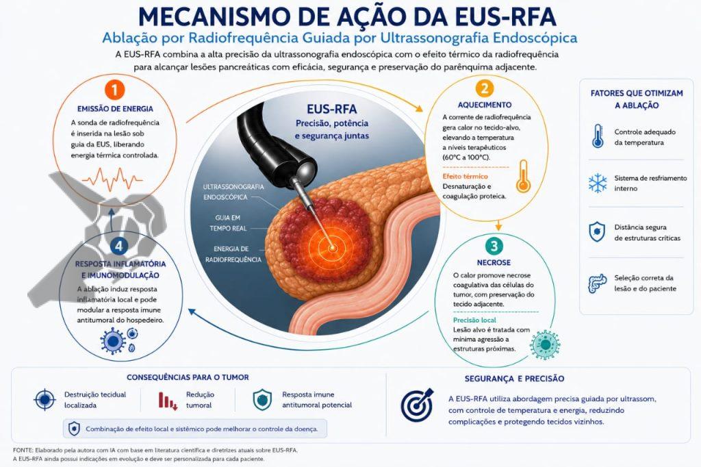Representação esquemática do mecanismo de ação da EUS-RFA pancreática